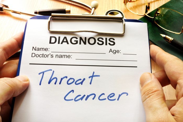 stage iv throat cancer
