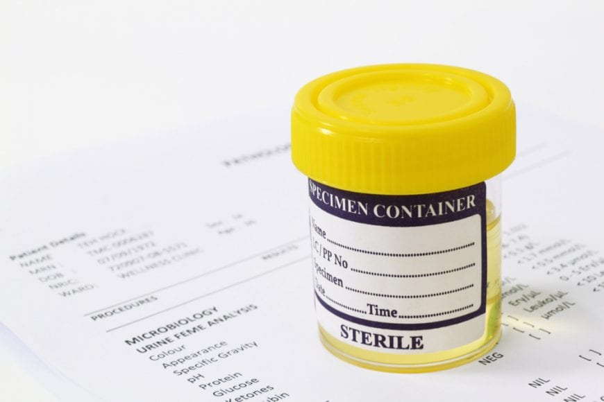 THC Detox Urine sample sitting on top of paperwork