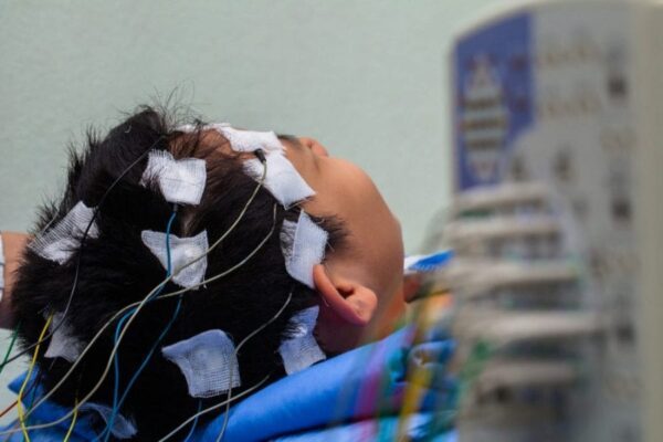 boy having an EEG with electrodes taped to his head