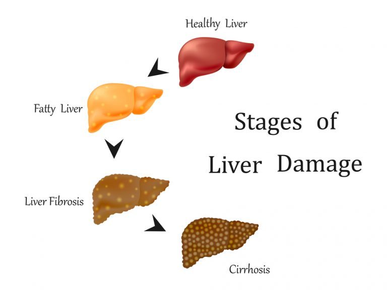 Liver Damage from Acetaminophen and CBD - RxLeaf