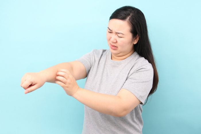 Have You Tried a THC Salve for Your Itchy Skin?